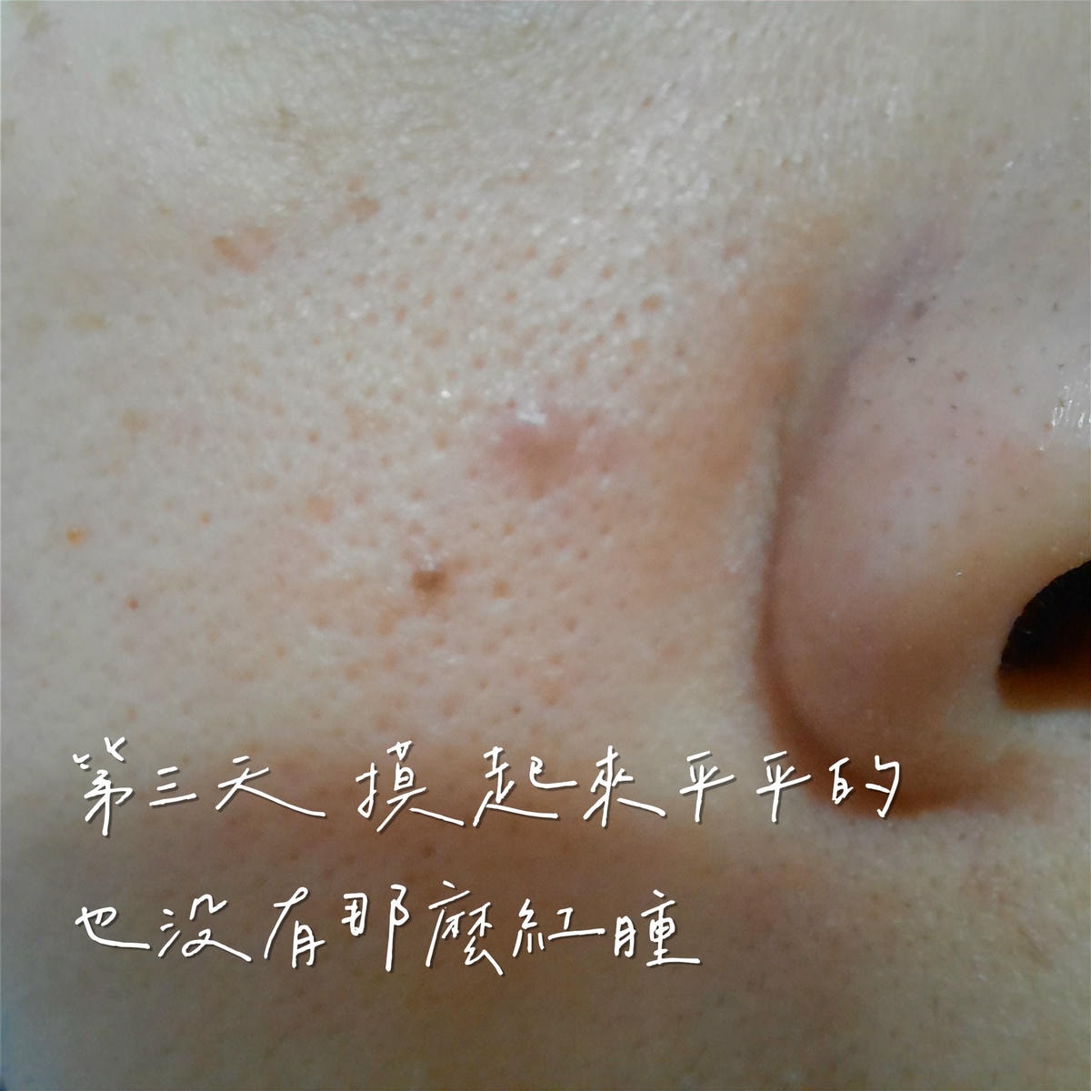 20250826-0ad8u