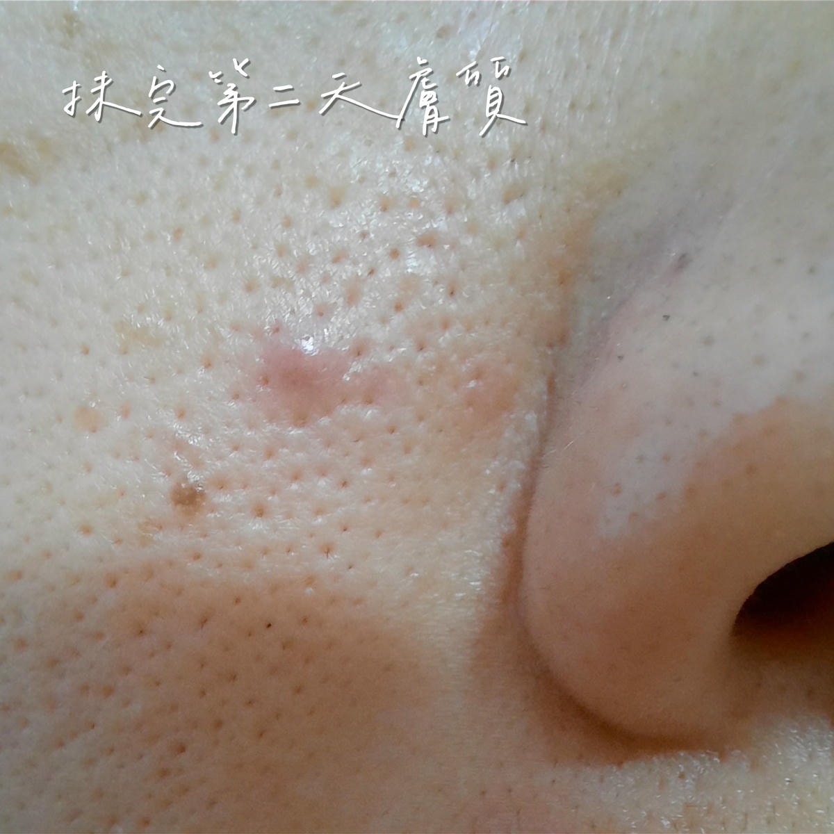 20250826-dezd8