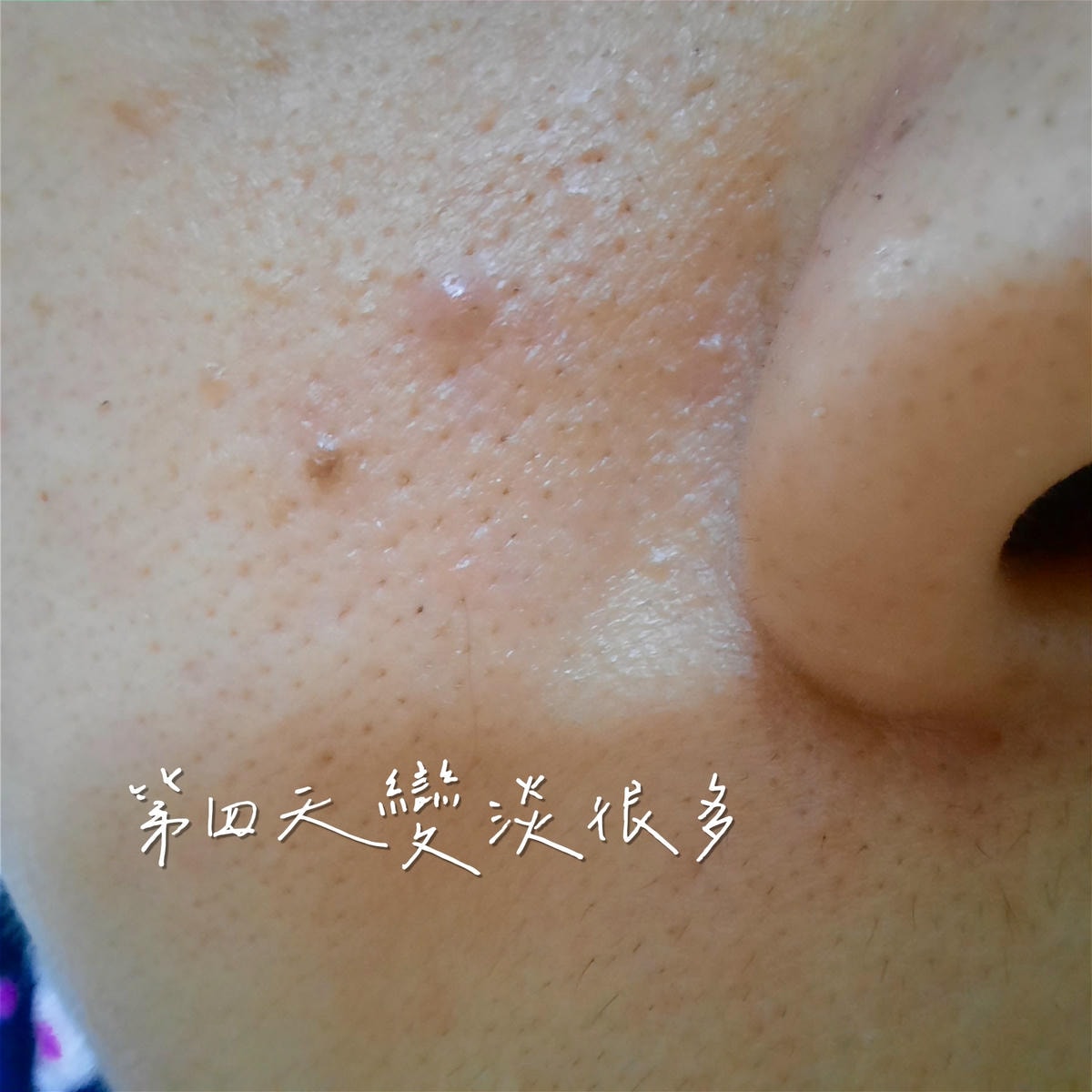 20250826-ynsw0